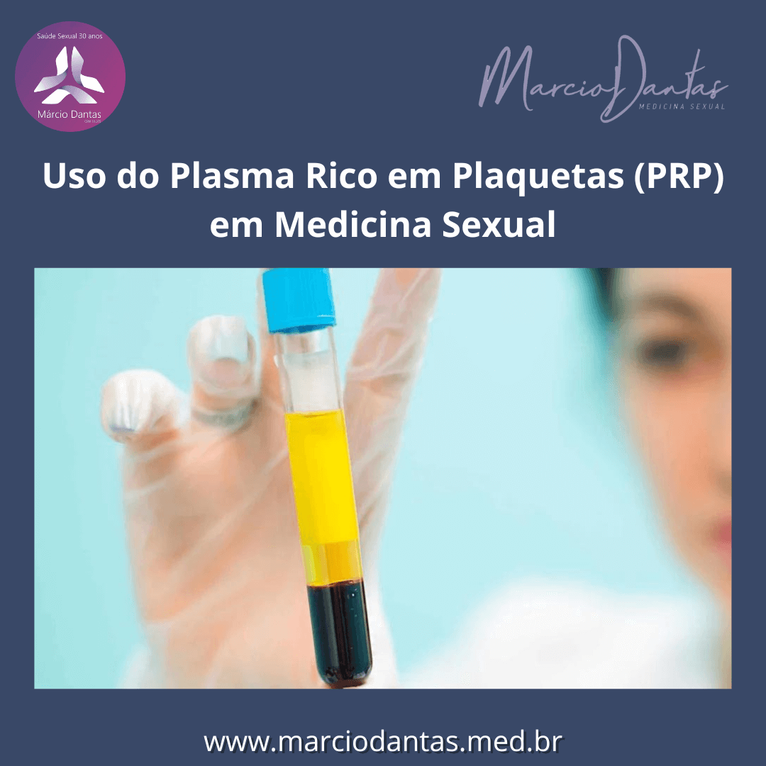 Uso do Plasma Rico em Plaquetas (PRP) em Medicina Sexual