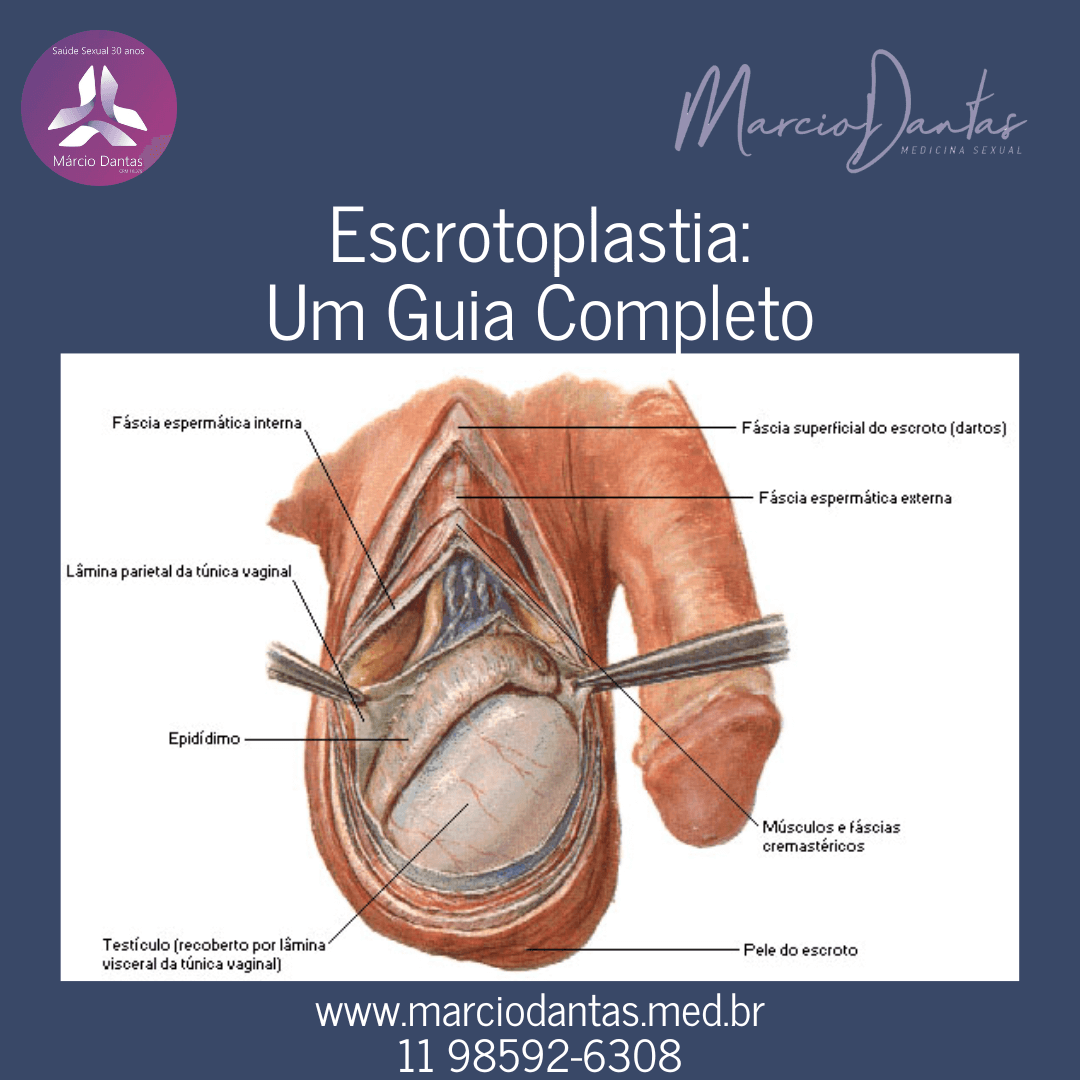 Escrotoplastia Um Guia Completo Dr. Marcio Dantas de Menezes Bolsa Escrotal