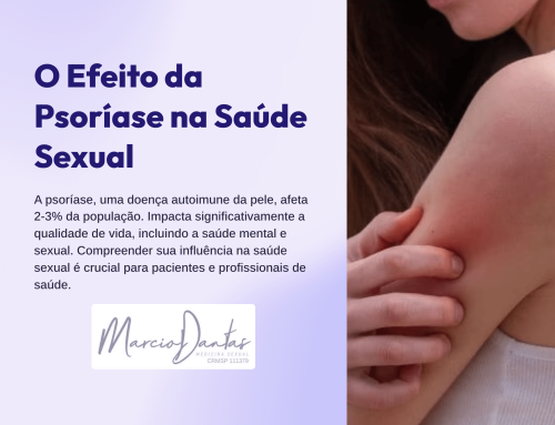 O Efeito da Psoríase na Saúde Sexual