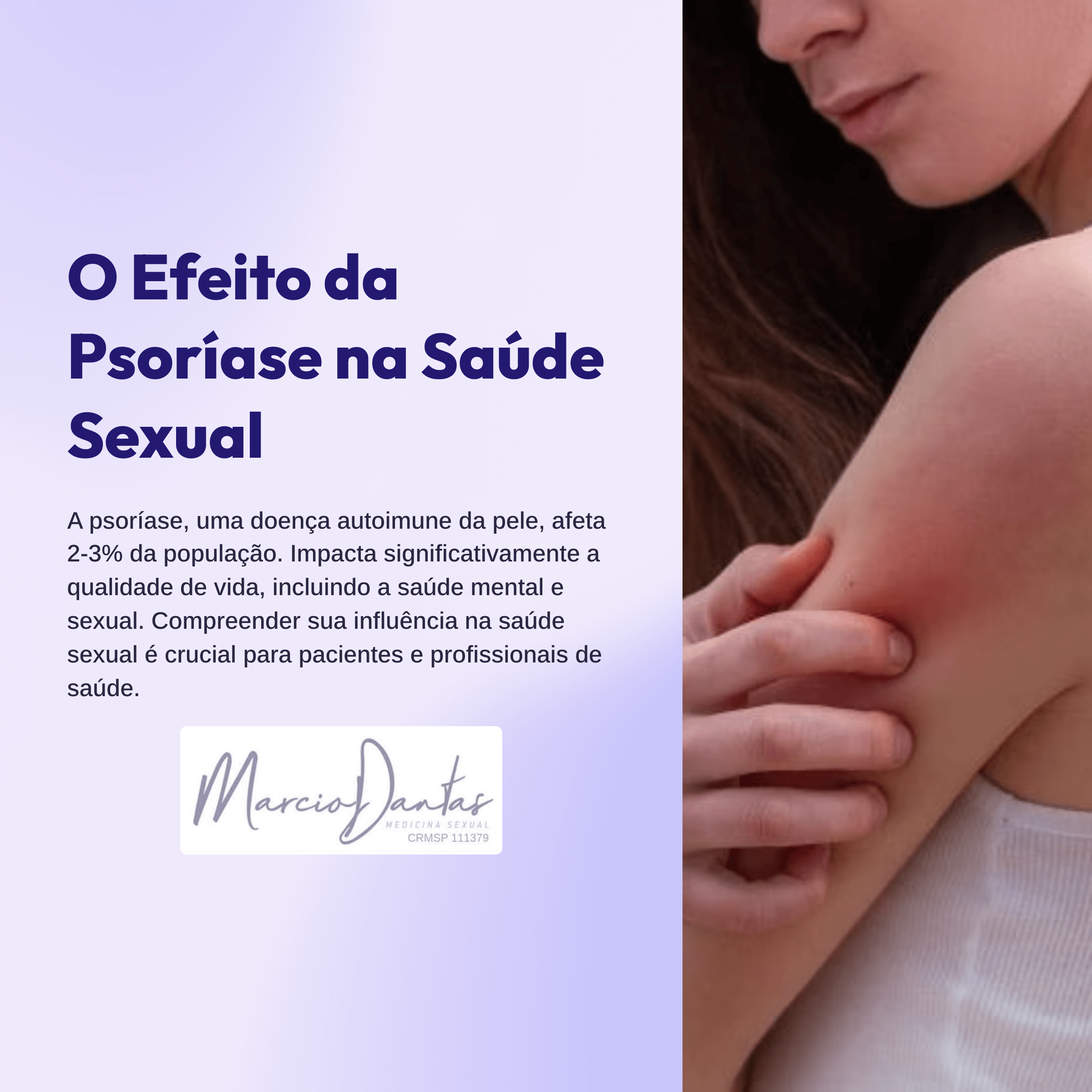 A psoríase, uma doença autoimune da pele, afeta 2-3% da população. Impacta significativamente a qualidade de vida, incluindo a saúde mental e sexual.